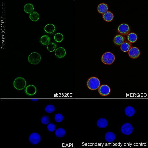 Anti-Cytokeratin 8 antibody [EP1628Y] - Cytoskeleton Marker(AB53280)