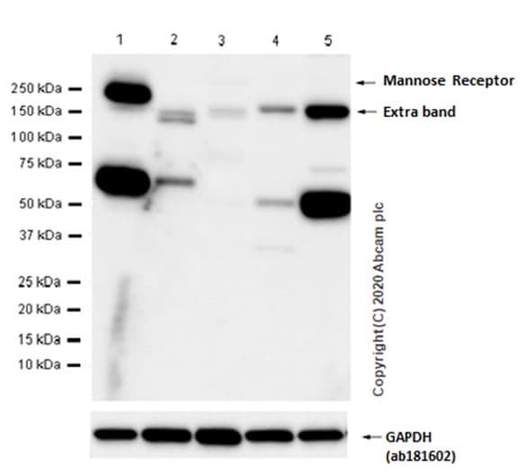 Mannose Receptor Antibody Epr6828b Bsa And Azide Free Ab209332  Western Blot Img20363
