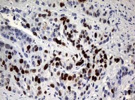 Anti-Ki67 antibody [OTI5D7](AB156956)