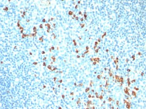Anti-Kappa light chain antibody [HP6053-L1C1](AB200546)