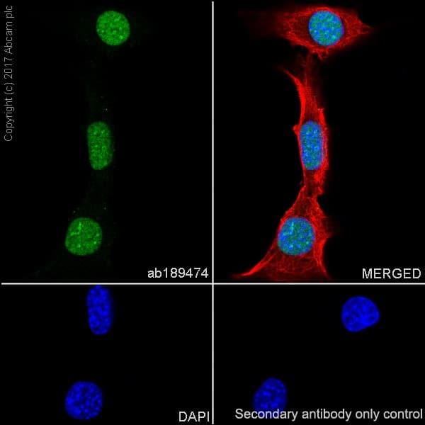 Anti-APE1 antibody [EPR18378-45] - ChIP Grade(AB189474)