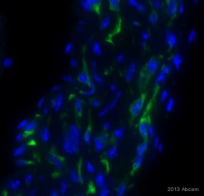 Anti-Desmin antibody [Y66] - Cytoskeleton Marker(AB32362)