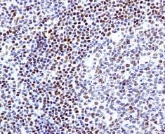 Anti-FOXP1 antibody [EPR4113](AB134055)
