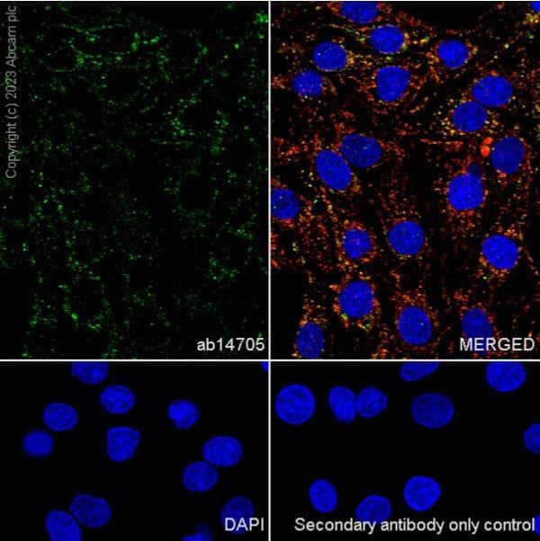 Anti-MTCO1 antibody [1D6E1A8](AB14705)