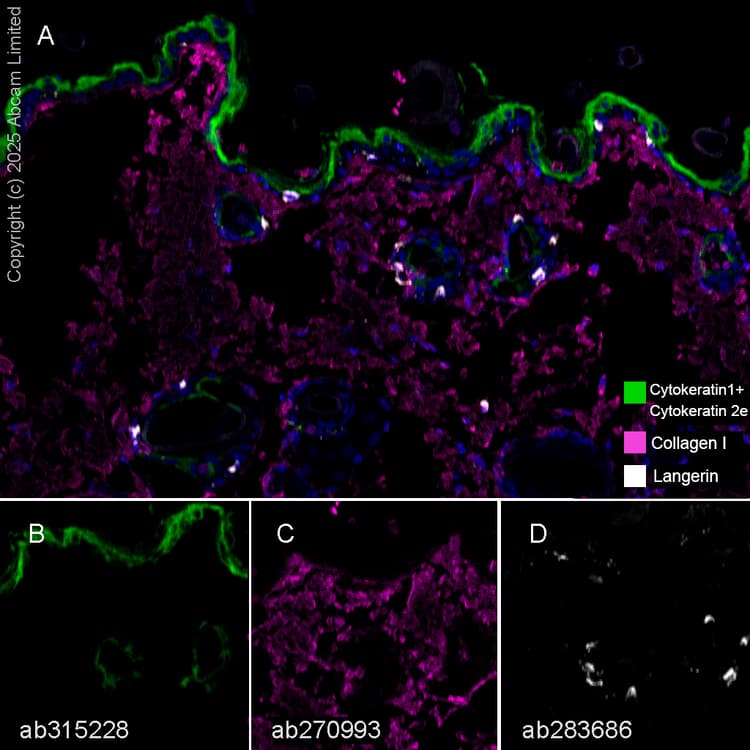 Anti-Collagen I antibody [EPR24331-53](AB270993)