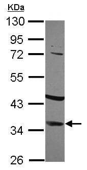 Anti-IGFBP2 antibody(AB227316)