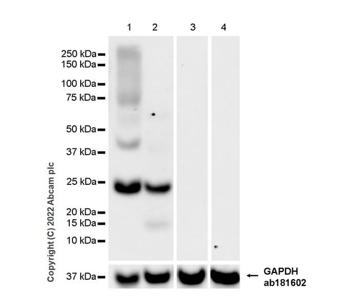 Anti-Aquaporin 5 antibody [EPR27474-70] - BSA and Azide free(AB305304)