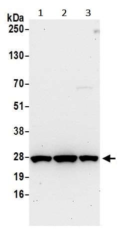 Anti-HPRT antibody(AB245397)