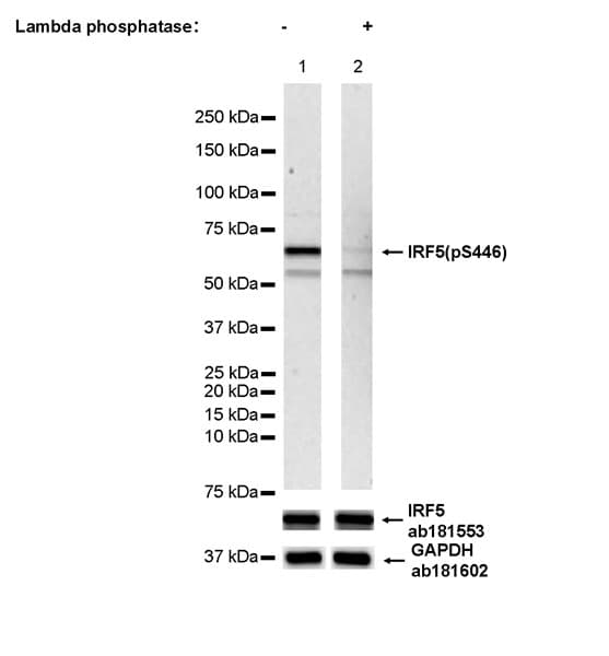 Anti-IRF5 antibody [EPR17067](AB181553)