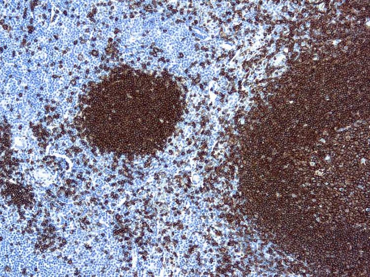 Anti-CD20 antibody [L26](AB9475)