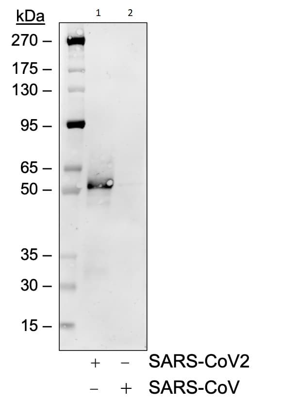 Anti-SARS-CoV-2 nucleocapsid protein antibody [75G5a](AB284653)