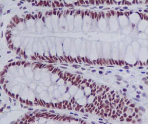Eftud2 Antibody Epr16055b Ab188327  Immunohistochemistry Formalin Pfa Fixed Paraffin Embedded Sections Img20990