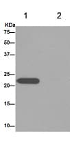 Lhfpl5 Antibody Epr16285 C Terminal Ab192242  Immunoprecipitation Img12540