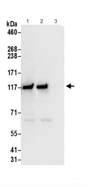 Anti-GART antibody(AB187716)