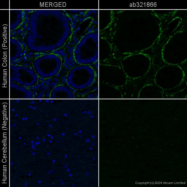 Goat Anti-Chicken IgY H&L (Alexa Fluor® 488) preadsorbed(AB150173)