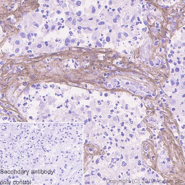 Anti-Collagen VI alpha 2 antibody [EPR7889(N)](AB180855)