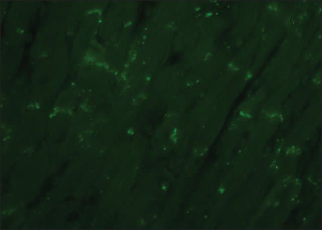 Anti-Connexin 43 / GJA1 antibody - Intercellular Junction Marker(AB11370)