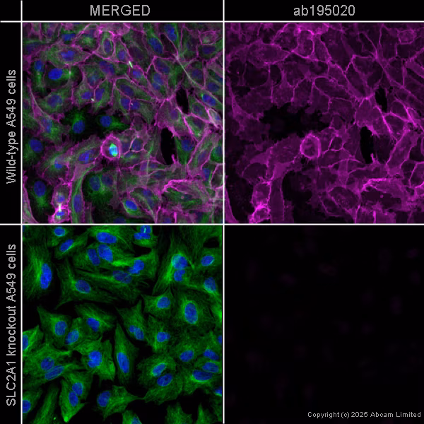 Alexa Fluor 647 Glucose Transporter Glut1 Antibody Epr3915 Ab195020 Immunocytochemistry Immunofluorescence Img453186