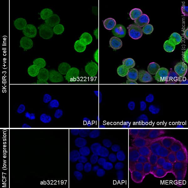 Anti-PADI2 / PAD2 antibody [EPR26940-85](ab322197)