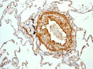 Anti-Calponin 1 antibody [EP798Y](AB46794)