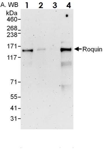 Anti-RC3H1 antibody(ab70195)