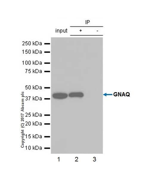 Anti-GNAQ antibody [EPR20978](AB210004)