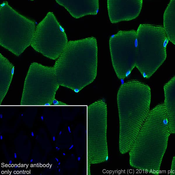 Anti-Ryanodine Receptor antibody [EPR21796](AB219798)