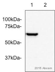 Anti-Tyrosine Hydroxylase antibody [EP1532Y] - Neuronal Marker(AB137869)