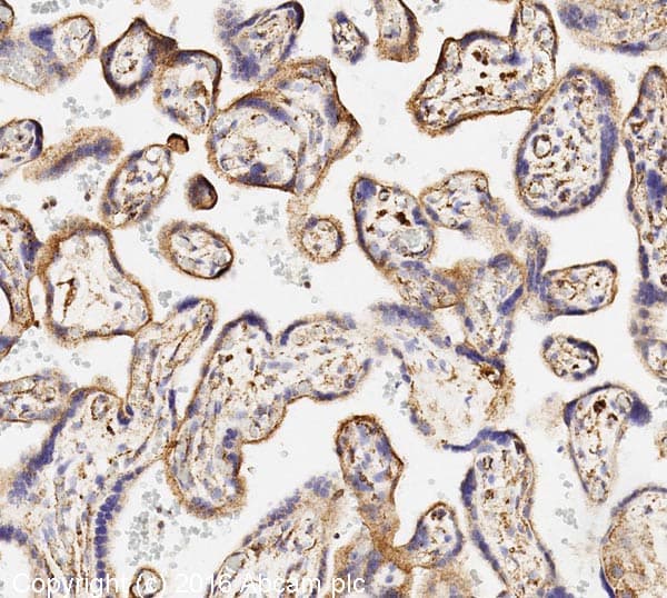Anti-LAMP1 antibody [H4A3](ab25630)