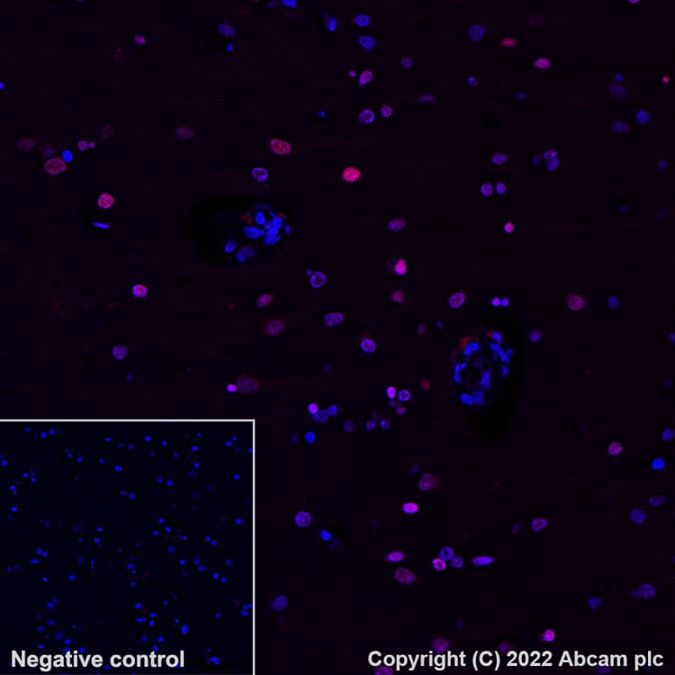 Alexa Fluor 647 Gamma H2ax Phospho S139 Antibody Ep8542y Ab195189  Immunohistochemistry Formalin Pfa Fixed Paraffin Embedded Sections Img400145