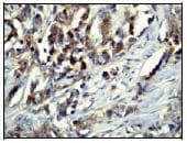 Eps15r Antibody Ep1147y Bsa And Azide Free Ab284699  Immunohistochemistry Formalin Pfa Fixed Paraffin Embedded Sections Img76497