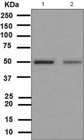 Anti-Vitamin D Receptor antibody [EPR4552] - ChIP Grade(AB109234)