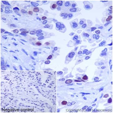 Caspase 2l Antibody Epr16790 Ab179519  Immunohistochemistry Formalin Pfa Fixed Paraffin Embedded Sections Img112263