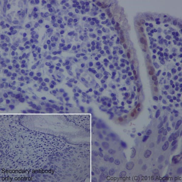 Gda Antibody Epr18751 Ab210606  Immunohistochemistry Formalin Pfa Fixed Paraffin Embedded Sections Img10216