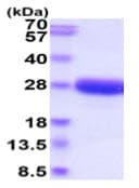 Recombinant Dog IL-6 protein (His tag)(AB219480)