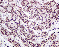 Nuclear Matrix Protein P84 Antibody Epr5661 Bsa And Azide Free Ab248100  Immunohistochemistry Formalin Pfa Fixed Paraffin Embedded Sections Img137091