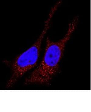 Anti-LC3B antibody(ab51520)