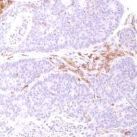 Anti-CD14 antibody [SP192](AB183322)