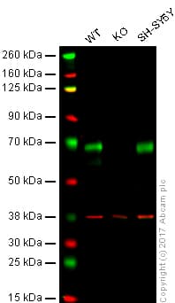 Bace1 Antibody Epr19523 Ab183612  Western Blot Img379