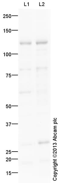 Ab14860  Western Blot Img71764