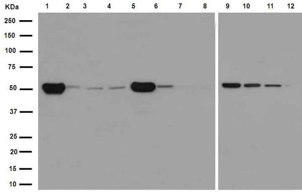 Anti-beta IV Tubulin antibody [EPR16775] - BSA and Azide free(AB250103)