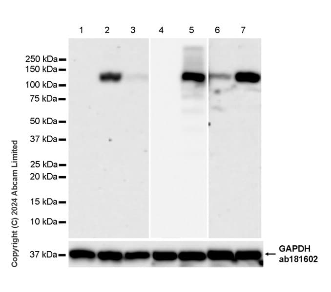 Anti-iNOS antibody [RM1017](AB283655)