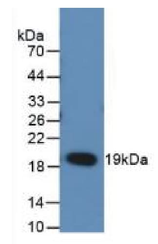 Anti-RANKL antibody [C1](AB239607)