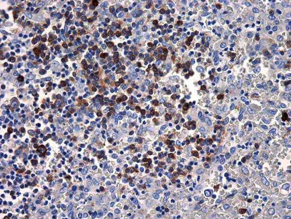 Anti-Human IgM antibody [R1/69](AB17104)
