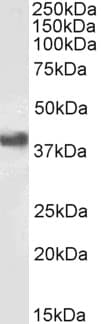 Cd32b Antibody Ab77093  Western Blot Img182231