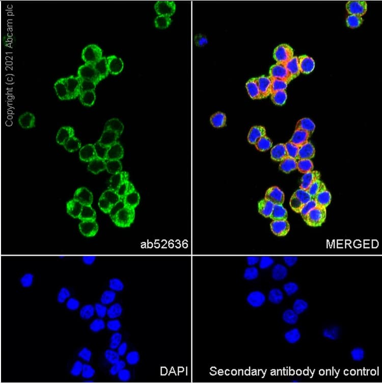 Synaptic Marker (Synaptophysin, Synapsin1, PSD95, VAMP2) Antibody Sampler Panel - Human, Mouse(AB263463)