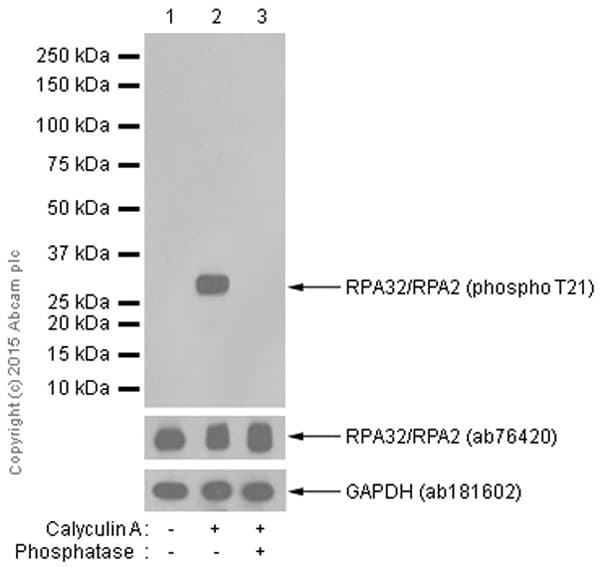 Anti-RPA32/RPA2 (phospho T21) antibody [EPR2846(2)](AB109394)