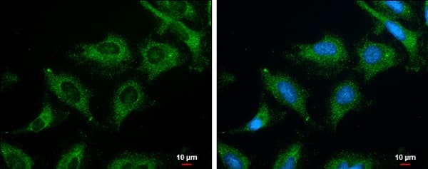 Anti-ROCK2 (phospho S1366) antibody(AB228008)