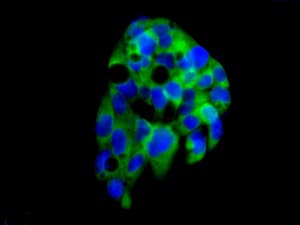 Lsm12 Antibody Epr12282 87 Ab173292  Immunocytochemistry Immunofluorescence Img14178