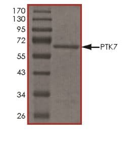 Recombinant Human CCK4 protein (Tagged)(AB268895)